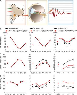 Syndromic Deafness Gene ATP6V1B2 Controls Degeneration of Spiral Ganglion Neurons Through Modulating Proton Flux